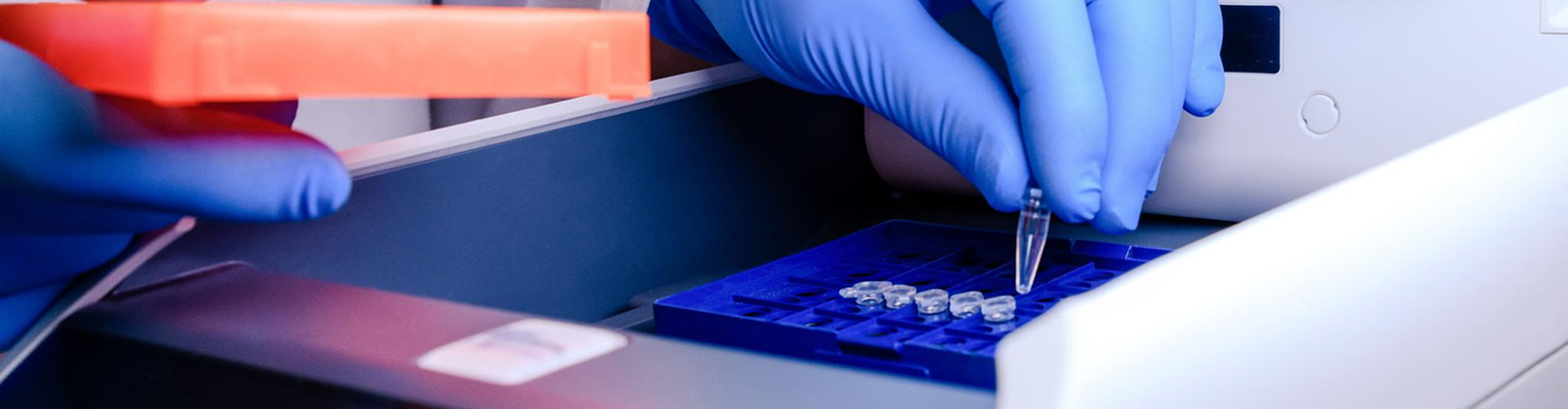 Test MxA e CRP in farmacia