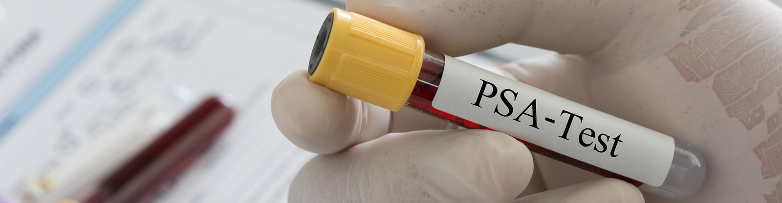 Test PSA in farmacia